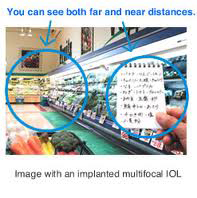 Multifocal IOL