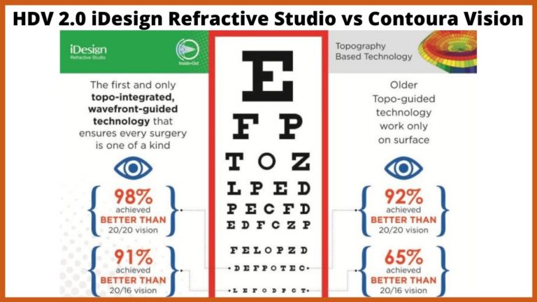 idesign refractive studio vs contoura vision